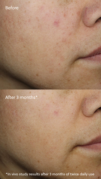 Vitamin C⁺ Serum 维生素C⁺精华